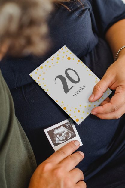 pregnancy milestone card with an ultrasound image of unborn baby